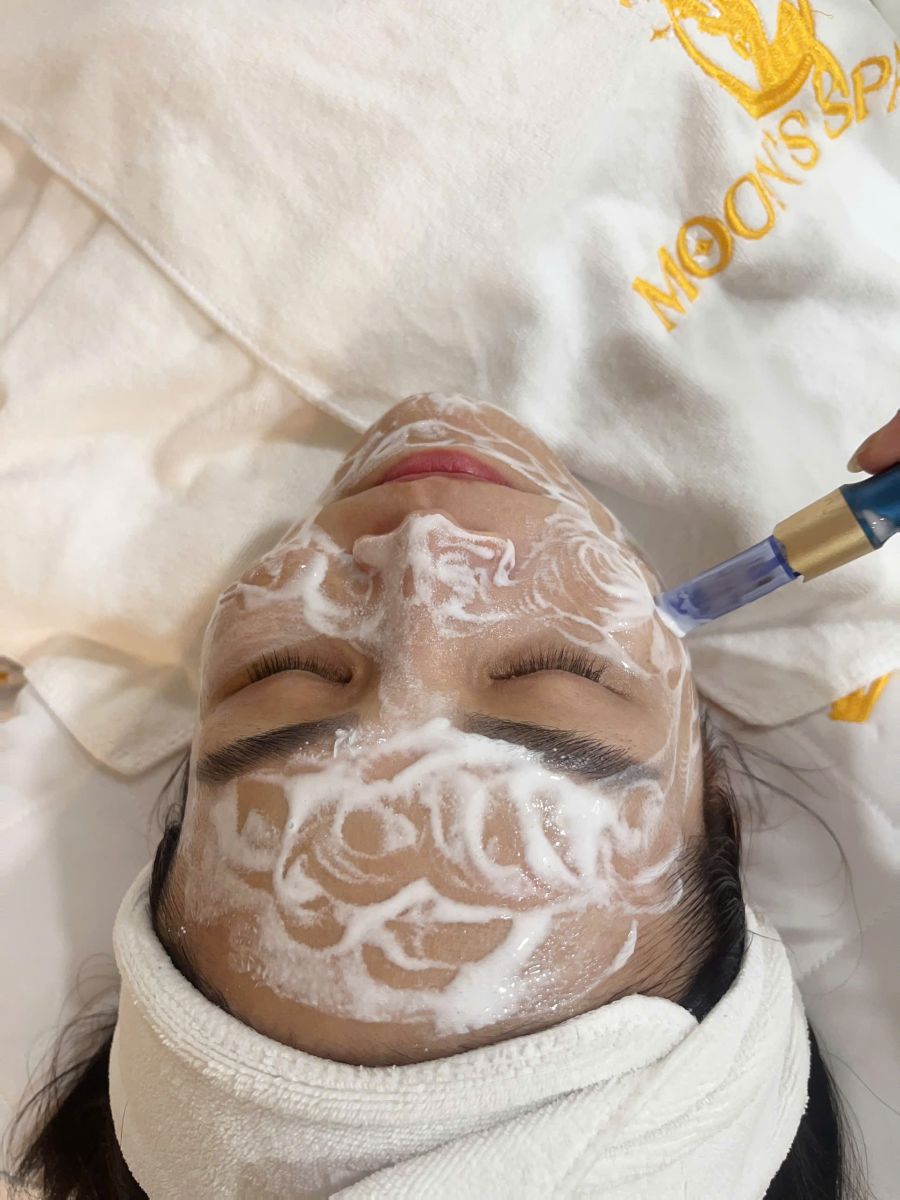 Cấy trắng NANO VIP